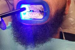 Office-Gallery-Carrollwood-Smiles-7