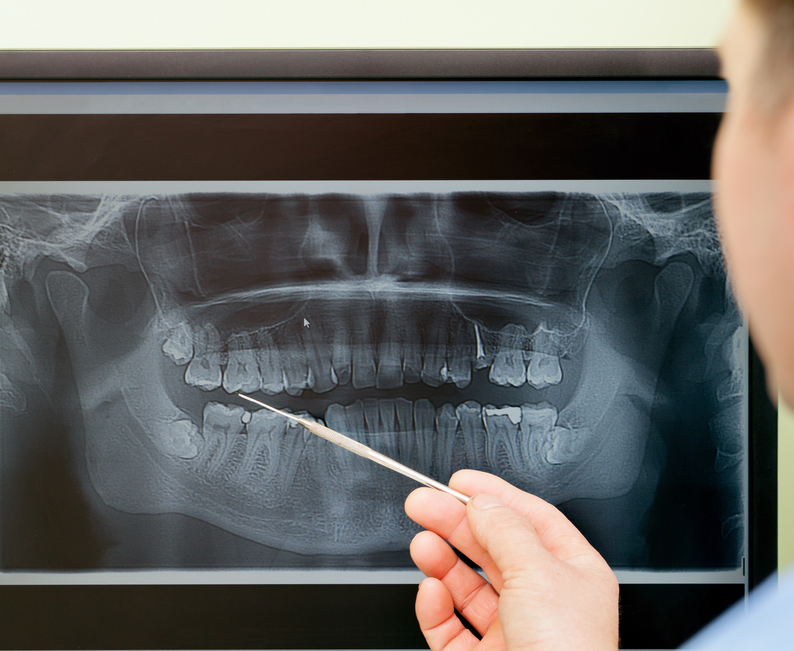 dentist reviewing a dental x-ray